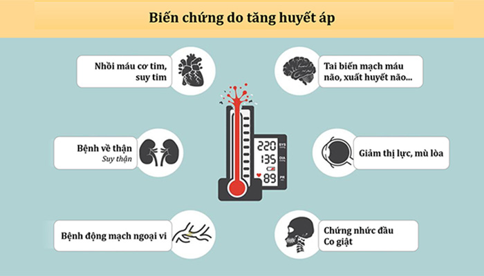 Khi chỉ số huyết áp quá cao dẫn đến nhiều biến chứng nguy hiểm đến sức khỏe