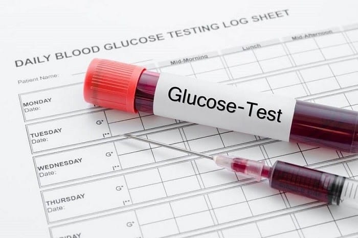 Quy trình test Glucose được thực hiện với những máy móc hiện đại