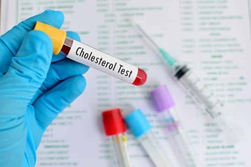 Xét nghiệm Cholesterol toàn phần là gì?