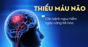 Thiếu máu lên não có nguy hiểm không