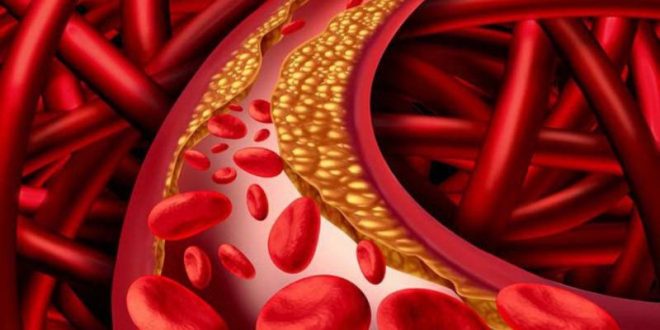 Ưu điểm của lá xạ đen giảm mỡ máu trong việc điều trị mỡ máu